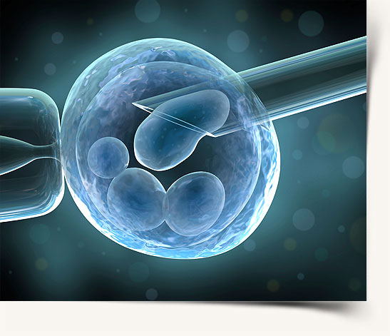 Preimplantation Genetic Diagnosis Sex Selection 112